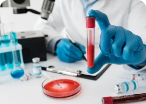 Diplomado Internacional en Hematología